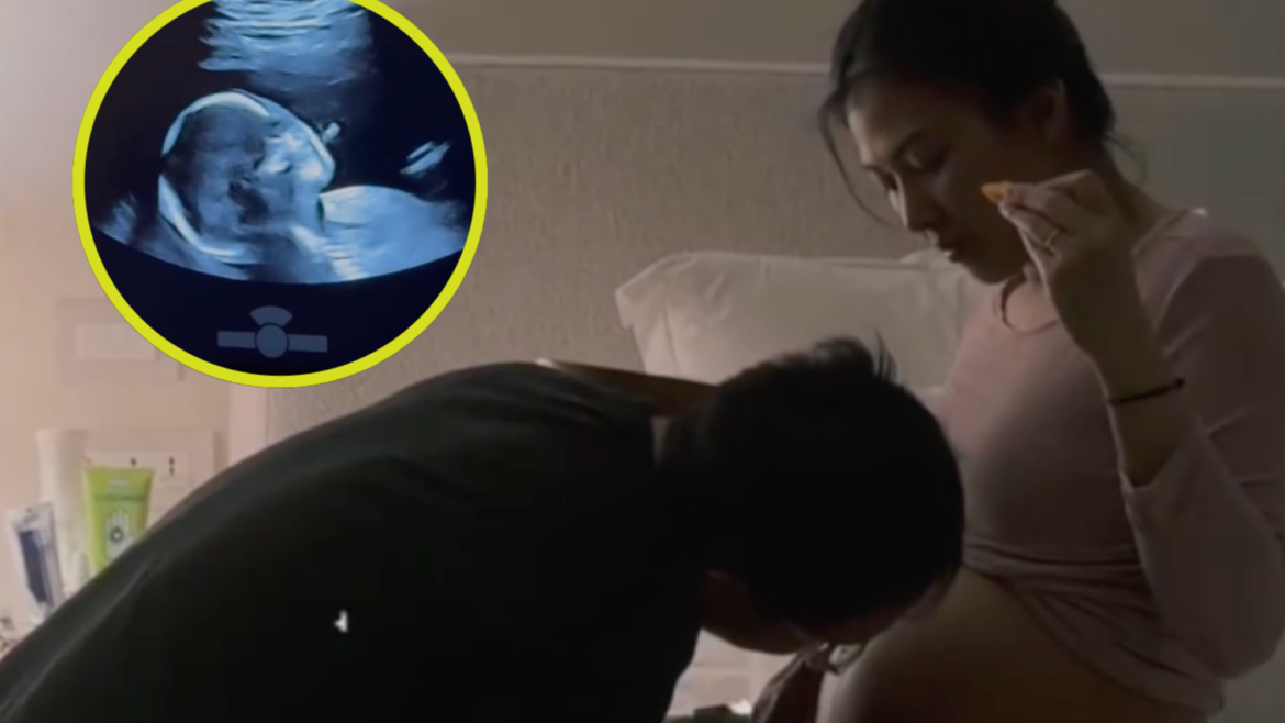 Alex Gonzaga pregnancy