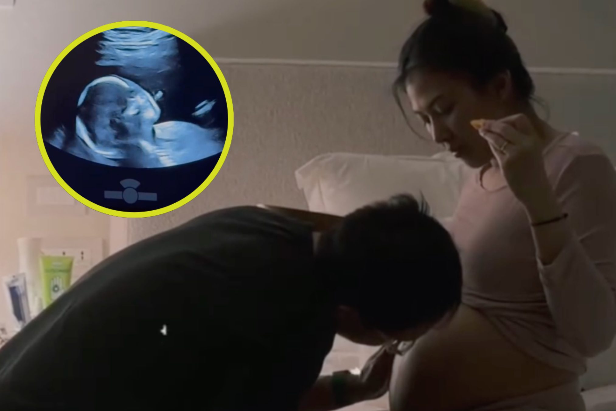 Alex Gonzaga pregnancy