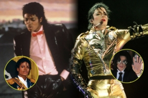 Michael Jackson vitiligo