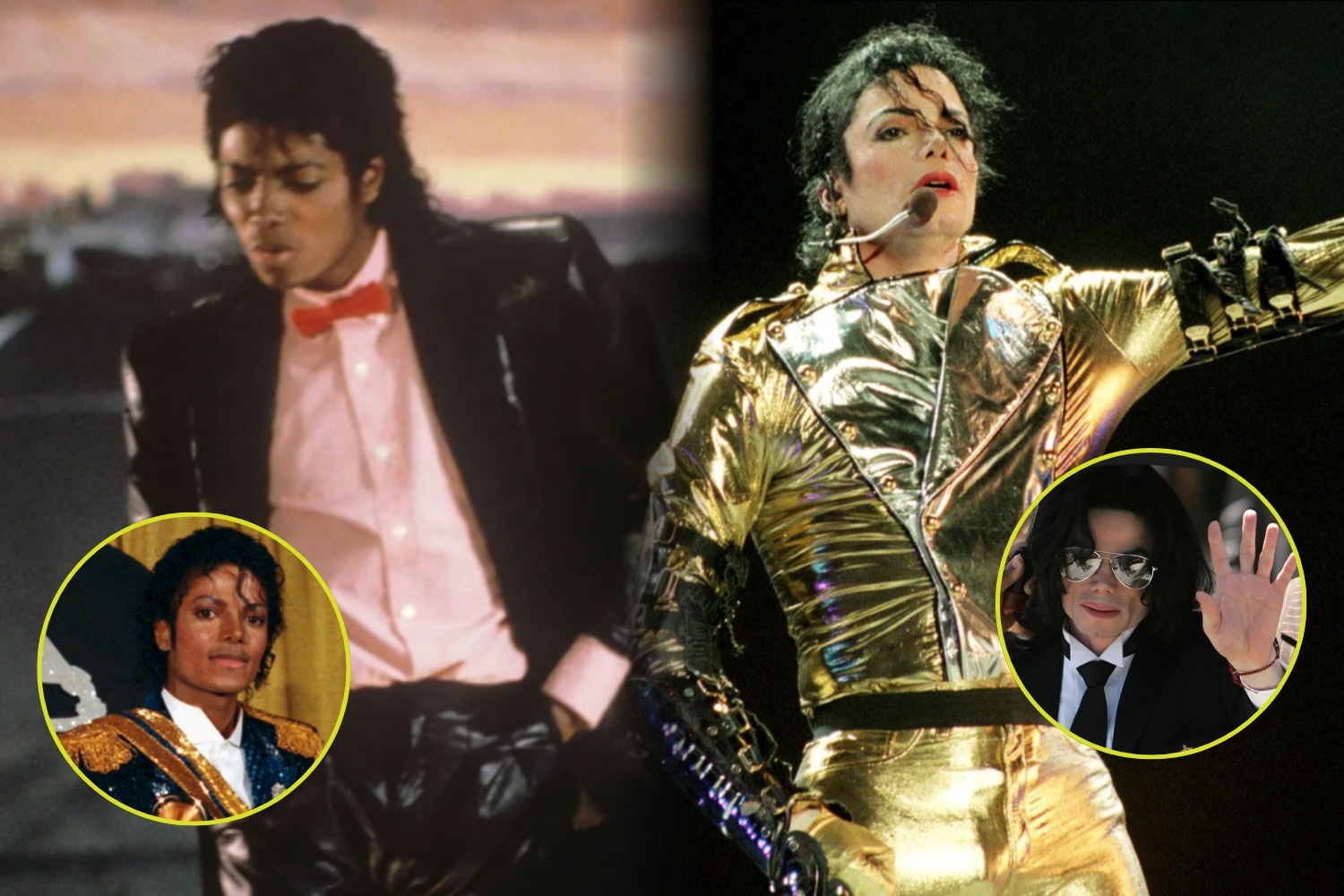 Michael Jackson vitiligo