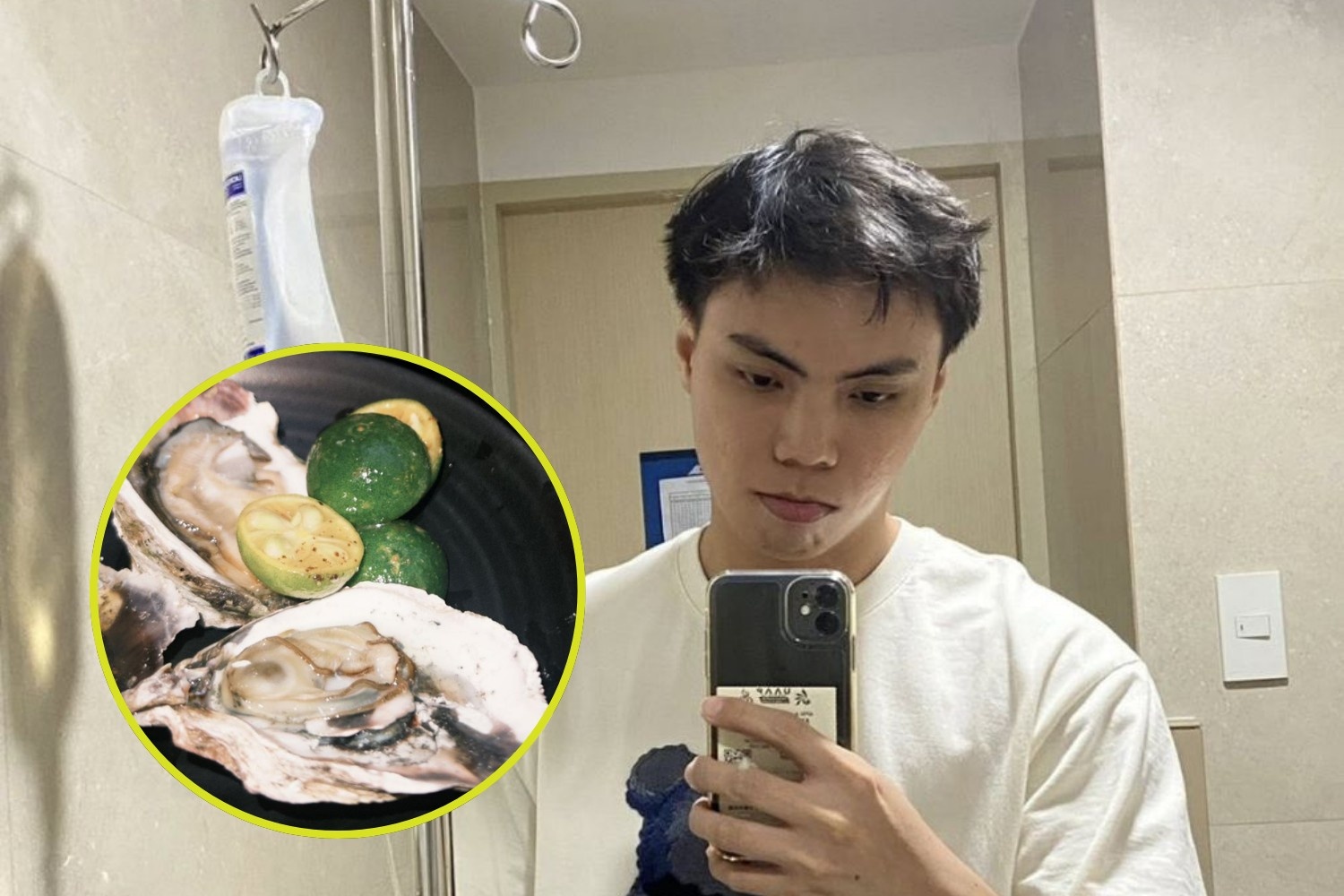Seafoods food poisoning