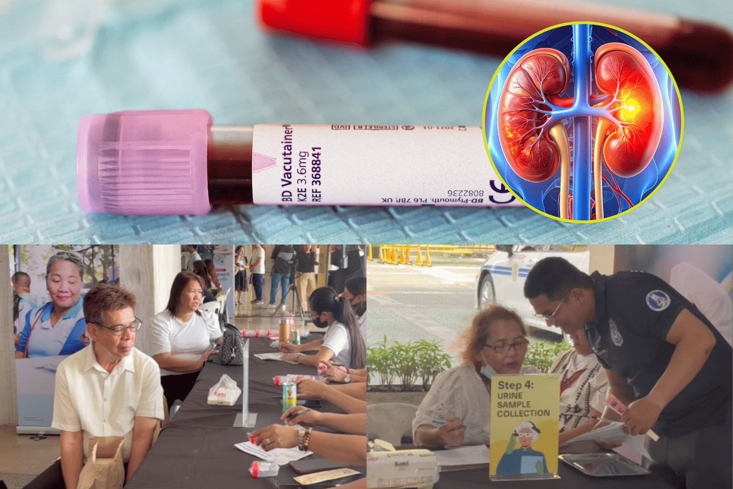 free kidney disease screening