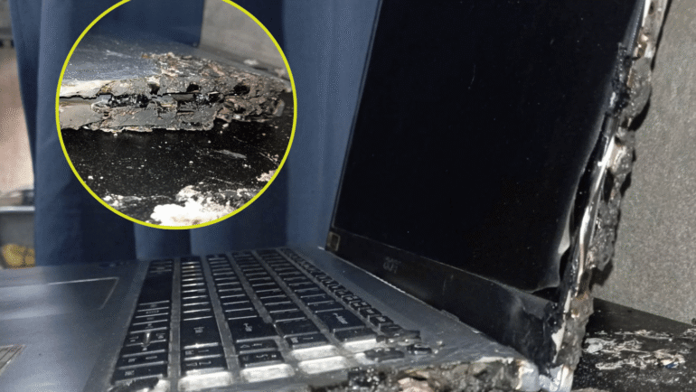 Burned laptop