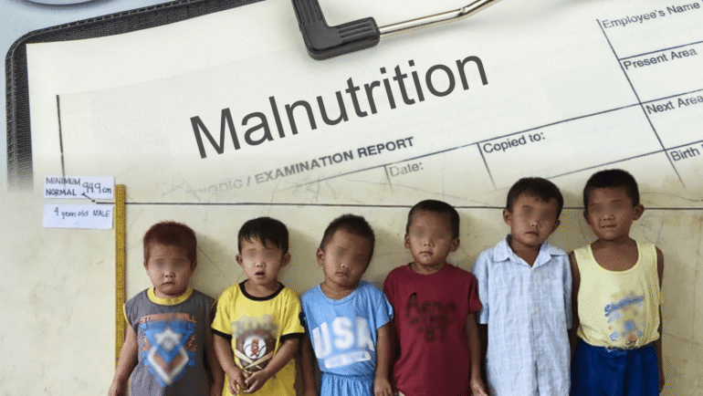 Chronic undernutrition