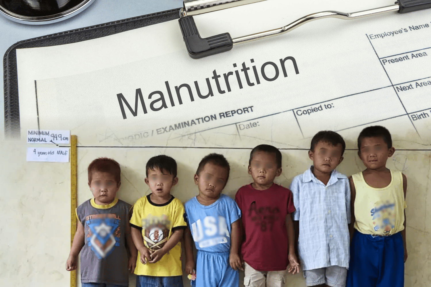 Chronic undernutrition